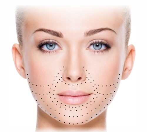 Biorewitalizacja twarzy. Techniki, etapy przebiegu, cechy zabiegu