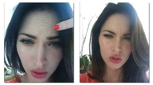 Megan Fox arcplasztika előtt és után. Fotó, amikor plasztikai műtétet végeztem az ajkakon, a szemeken, az orron, az arccsonton