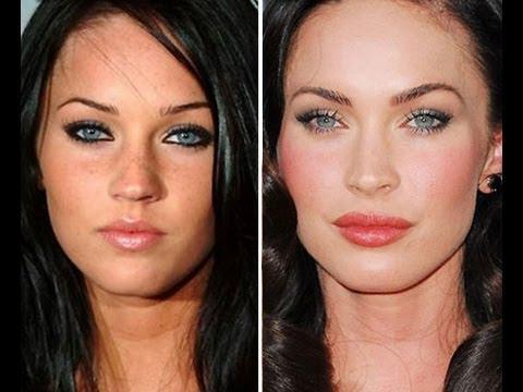 Megan Fox arcplasztika előtt és után. Fotó, amikor plasztikai műtétet végeztem az ajkakon, a szemeken, az orron, az arccsonton