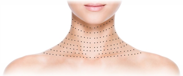 Liệu pháp Plasma - Plasmolifting của da mặt và cổ, chỉ định, chống chỉ định, hình ảnh, giá của thủ thuật, đánh giá