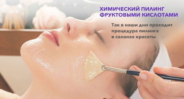 Peeling químico de la cara: qué es, cómo se hace en casa, tipos y características.