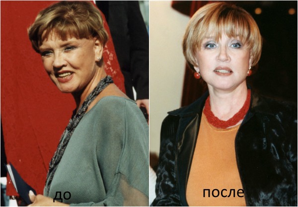 Vera Alentova - fotó plasztikai műtét előtt és után, a színésznő jelenlegi kinézete, életrajz