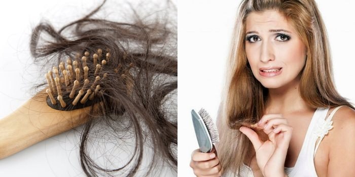 Wypadanie włosów u kobiet - jak przestać, co robić: szampony, olejki, maski, kompleksy witaminowe