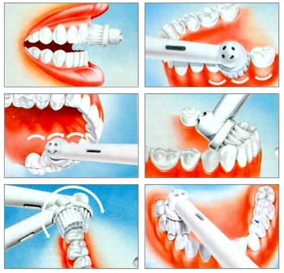 Raspall de dents per ultrasons. Pros i contres, ressenyes dels metges, valoració dels millors i contraindicacions