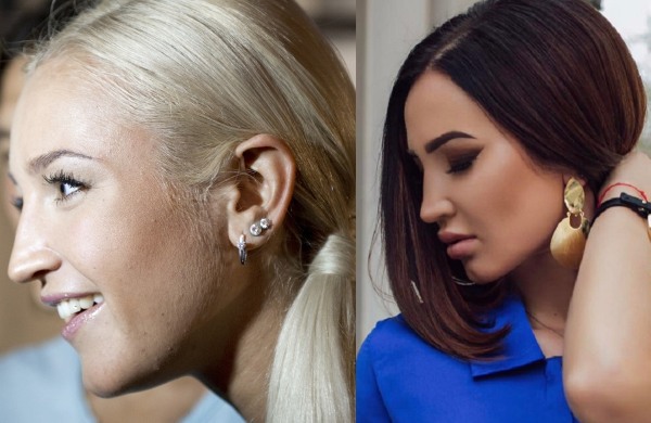 Olga Buzova - fotók az orr, az ajkak, az arccsont plasztikai műtétje előtt és után. Hogyan fogytam, milyen plasztikai műtétet végeztem
