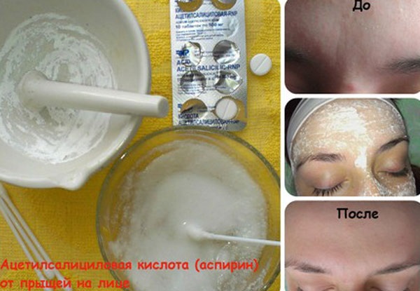 Àcid acetilsalicílic per a la pell facial. Receptes per a màscares, peeling per a l'acne, arrugues. Resultats i fotos
