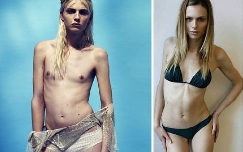 Andrey Pezhich trước và sau khi phẫu thuật chuyển đổi giới tính. Những bức ảnh thời trẻ và bây giờ, câu chuyện luân hồi