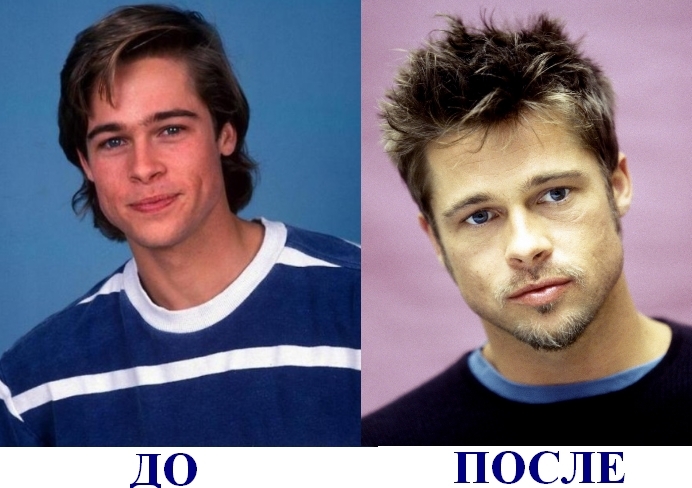 Hình ảnh trước và sau nhựa của các ngôi sao Nga, nước ngoài, Hollywood, trình diễn kinh doanh, sân khấu. Hoạt động thành công và không thành công