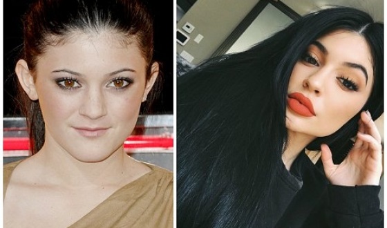 Kylie Jenner trước và sau khi phẫu thuật thẩm mỹ: ảnh không trang điểm, photoshop, mặc áo tắm, khi mang bầu. Bao nhiêu tuổi, chiều cao, các thông số, tiểu sử