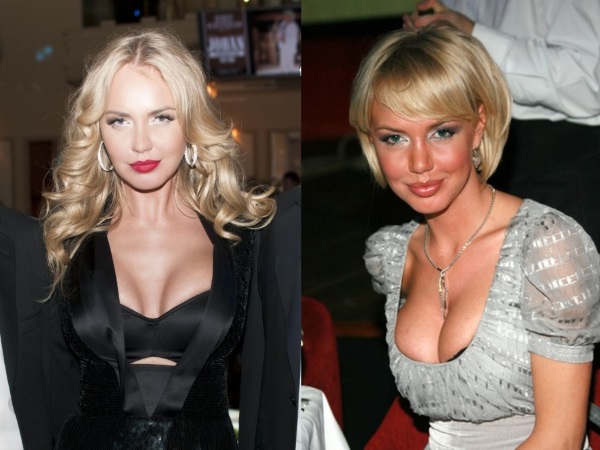 Nữ diễn viên Nga ngực khủng trước và sau khi phẫu thuật thẩm mỹ. Một bức ảnh