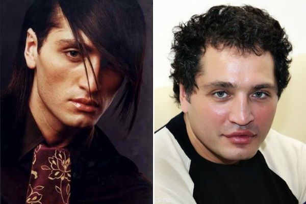 Rustam Solntsev przed i po operacji plastycznej. Zdjęcie, jak to wygląda teraz