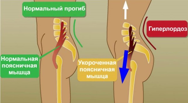 El múscul iliopsoas. Exercicis d’enfortiment, estiraments, com fer bombes