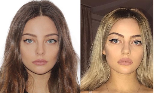 Katya Kishchuk. Ảnh nóng từ Instagram, không trang điểm, trước và sau khi phẫu thuật thẩm mỹ, tiểu sử