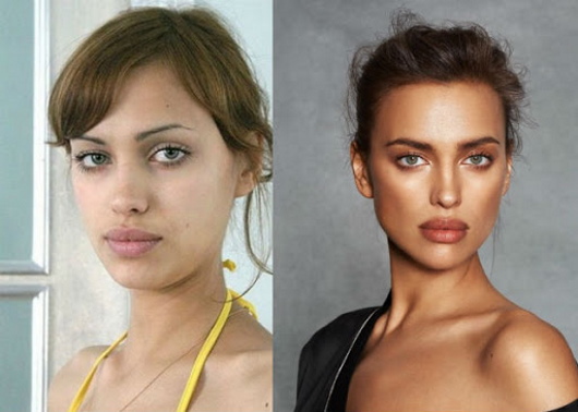 Irina Shayk. Fotos calientes en traje de baño, antes y después de la cirugía plástica, biografía.