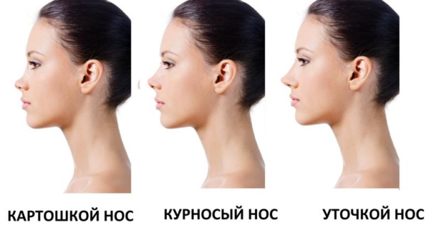 Dziewczyna ma zadarty nos. Jak naprawić zdjęcia przed i po korekcji nosa