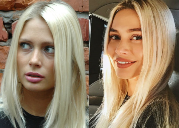 Natalia Rudova przed i po operacji plastycznej, gorące zdjęcia w stroju kąpielowym, biografia