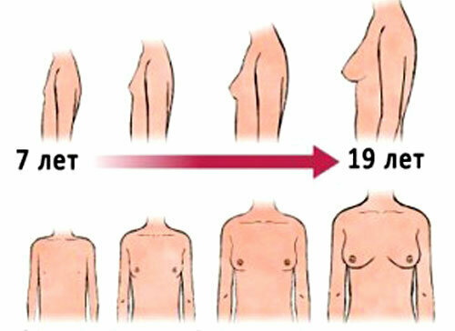 Apa yang perlu dilakukan untuk menjadikan payudara tumbuh lebih cepat untuk seorang gadis di bawah 18 tahun