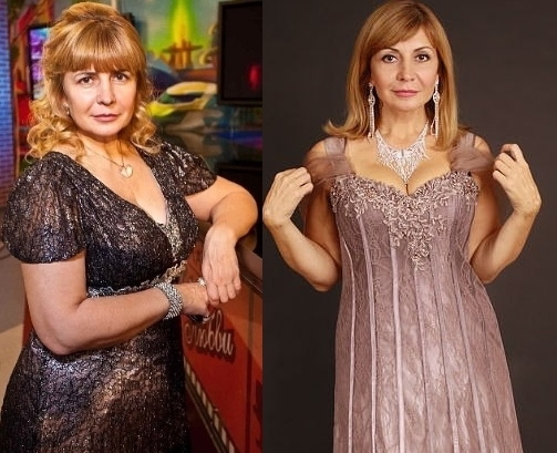 Irina Agibalova. Hình ảnh trước và sau khi phẫu thuật, giảm cân