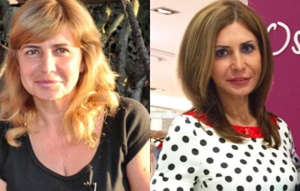 Irina Agibalova. Hình ảnh trước và sau khi phẫu thuật, giảm cân