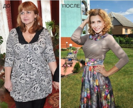 Irina Agibalova. Foto prima e dopo l'intervento chirurgico, perdita di peso