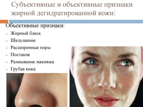 Hauttypen in der Kosmetik. Einstufung, Bestimmungskriterien, Foto