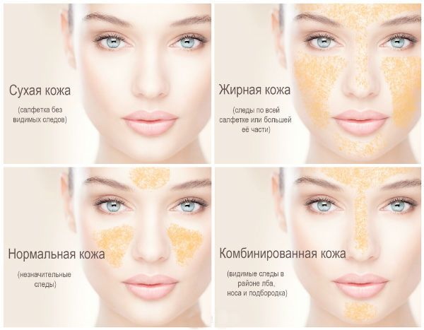 Tipi di pelle in cosmetologia. Classificazione, criteri di determinazione, foto